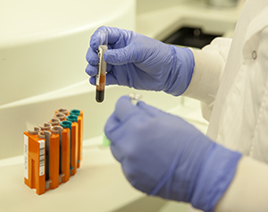 Closeup of hands with lab equipment and blood samples.